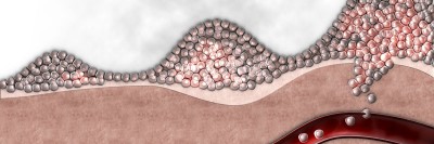 Graphical representation of cells leaking into bloodstream
