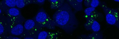 Macropinocytosis
