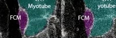 Video: PI(4,5)P2 Colocalizes with the F-actin Focus at the Invasive Podosome