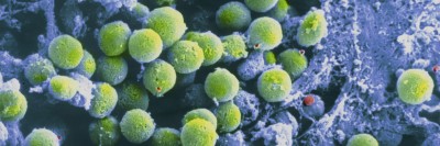 Pictured: Developing white blood cells called T cells on the surface of the thymus. T cells defend the body from foreign intruders such as bacteria, viruses, and fungi, and may also protect against cancer.